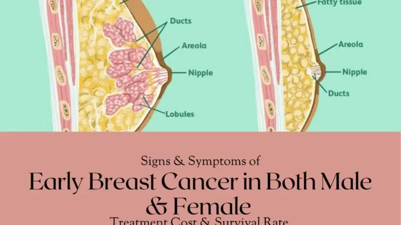 Early breast cancer